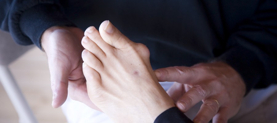Bunion Treatment Near Me in Orange, CA Bunion Treatment Near Me in Orange, CA