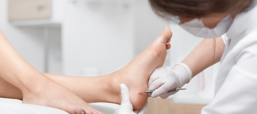 Podiatrist Callus Removal Cost Near Me in Orange, CA Podiatrist Callus Removal Cost Near Me in Orange, CA