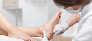 Podiatrist Callus Removal Cost Near Me in Orange, CA Podiatrist Callus Removal Cost Near Me in Orange, CA