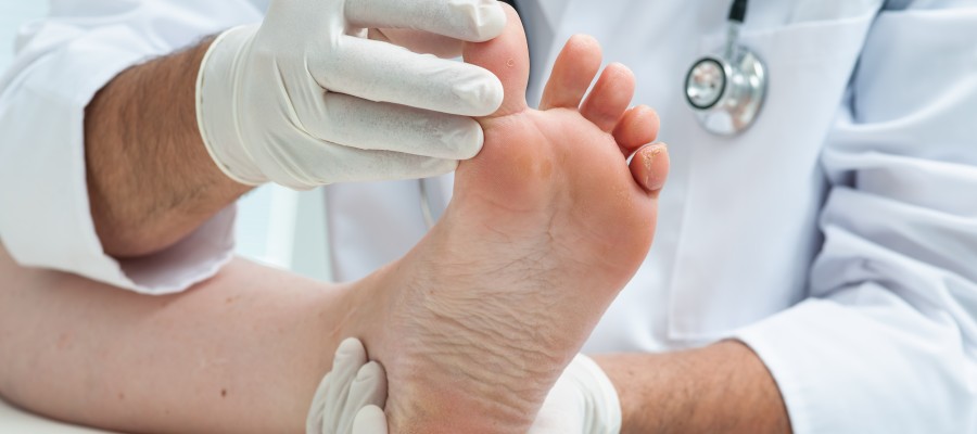 Charcot Foot Treatment Near Me in Orange, CA Charcot Foot Treatment Near Me in Orange, CA