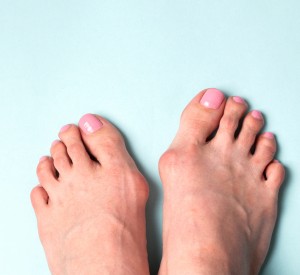 Foot Deformity Treatment Near Me in Orange, CA