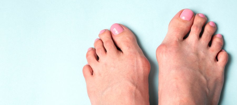 Foot Deformity Treatment Near Me in Orange, CA