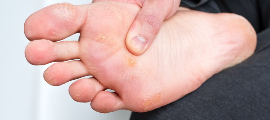 Foot Fungus Doctor Near Me in Orange, CA Foot Fungus Doctor Near Me in Orange, CA