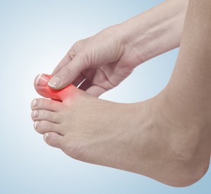 Hammertoe Treatment Near Me in Orange, CA