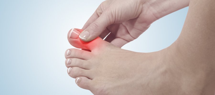Hammertoe Treatment Clinic Near Me in Orange, CA Hammertoe Treatment Clinic Near Me in Orange, CA