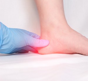 Planter Fasciitis Treatment Near Me in Orange, CA