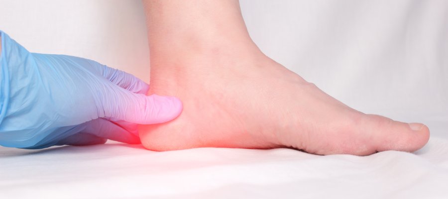 What are the Causes of Plantar Fasciitis Near Me in Orange, CA What are the Causes of Plantar Fasciitis Near Me in Orange, CA