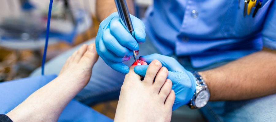 Laser Fungal Nail Treatment Near Me in Orange, CA Laser Fungal Nail Treatment Near Me in Orange, CA