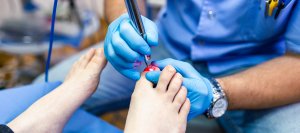 Laser Fungal Nail Treatment Near Me in Orange, CA Laser Fungal Nail Treatment Near Me in Orange, CA