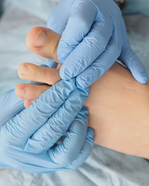 Laser Fungal Nail Treatment Near Me in Orange, CA