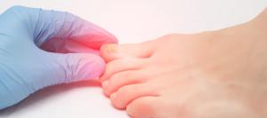 Podiatrist Near Santa Ana, CA Podiatrist Near Santa Ana, CA