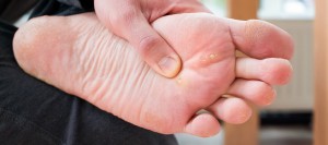Swift Wart Treatment Specialist Near Me in Orange, CA Swift Wart Treatment Specialist Near Me in Orange, CA