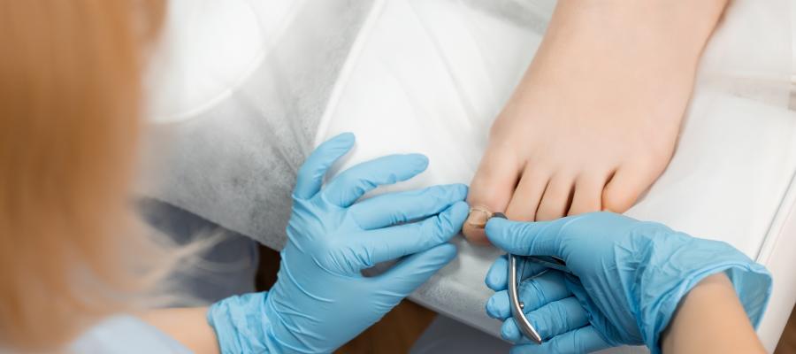 Cost of Toenail Fungus Laser Treatment Near Me in Orange, CA