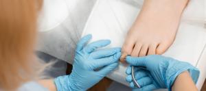 Cost of Toenail Fungus Laser Treatment Near Me in Orange, CA