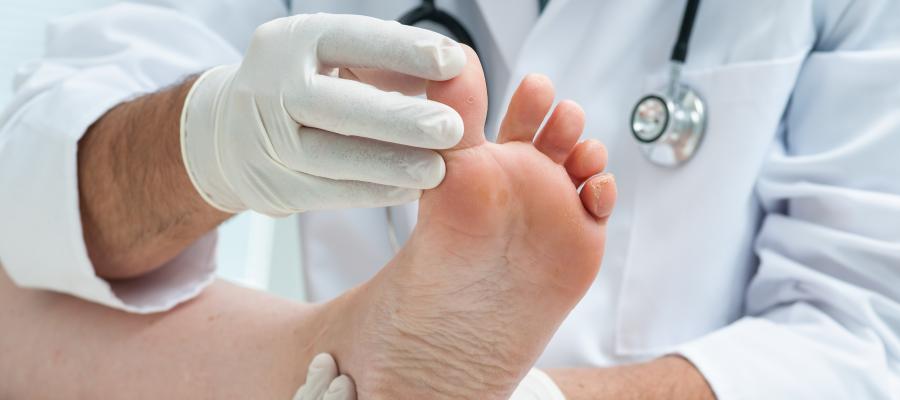 Toenail Fungus Laser Treatment Specialist Near Me in Orange, CA