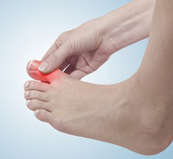 Hammertoe Treatment Near Me in Orange, CA