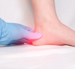 Planter Fasciitis Treatment Near Me in Orange, CA