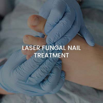 Laser Fungal Nail Treatment Near Me in Orange, CA
