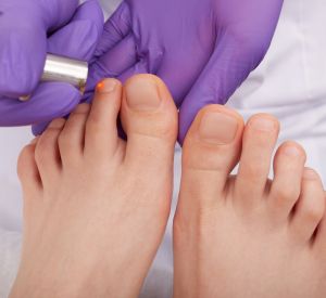 Remy Laser, for Pain/Inflammation in Orange, CA