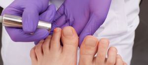 Remy Laser for Foot Pain Treatment Near Me in Orange, CA Remy Laser for Foot Pain Treatment Near Me in Orange, CA