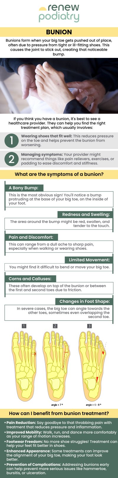 Dr. Charles Baik specializes in bunion treatments in Orange, CA. At Renew Podiatry, our expert podiatrist provides personalized care for bunions, helping alleviate pain and improve foot function. We also treat a range of other foot and ankle issues such as gout, heel pain, ingrown nails, nail fungus, and diabetic foot problems. Contact us today or schedule an appointment online! We are conveniently located at 705 West La Veta Ave, Suite 109, Orange, CA 92868.