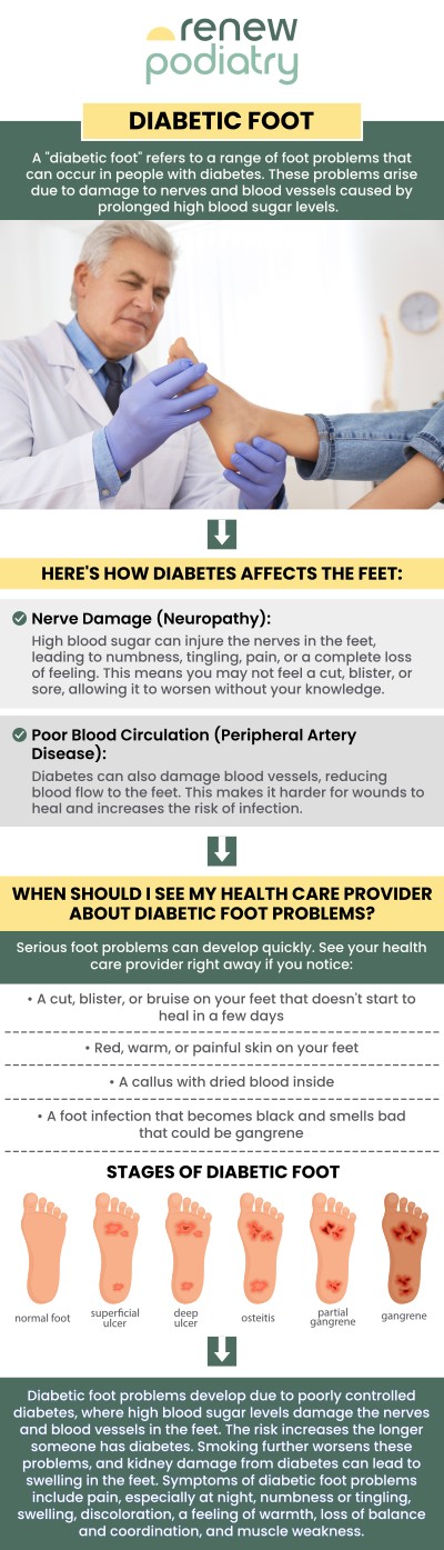 The majority of foot issues that diabetics experience are brought on by the disease's two most significant complications: nerve damage and impaired circulation. In order to maintain general health and avoid serious foot issues, diabetic patients must carefully examine their feet each day. If you suffer from diabetic foot-related issues, Dr. Charles Baik DPM at Renew Podiatry offers diabetic foot treatment to help relieve your discomfort. Contact us for more information or schedule an appointment online! We are conveniently located at 705 West La Veta Ave, Suite 109, Orange, CA 92868.