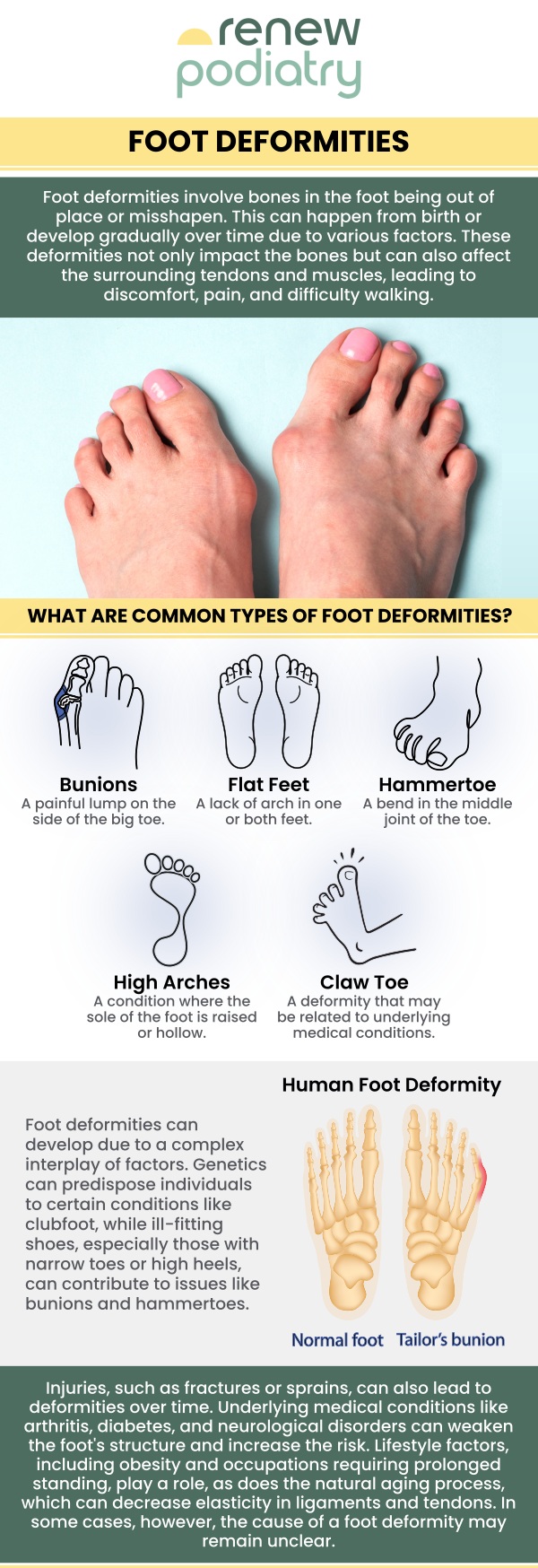 Foot deformities are a diverse range of congenital and acquired diseases that impact the foot's ability to function due to structural defects or muscle imbalances. Foot deformity can be a serious problem. At Renew Podiatry our expert podiatrist Dr. Charles Baik DPM, treats various foot deformities including hammertoe, bunion, flat feet & high arched feet. Contact us today for more information or schedule an appointment online! We are conveniently located at 705 West La Veta Ave, Suite 109, Orange, CA 92868.