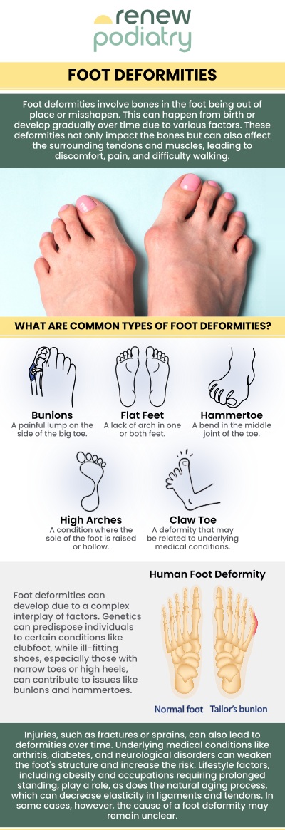 Foot deformities are a diverse range of congenital and acquired diseases that impact the foot's ability to function due to structural defects or muscle imbalances. Foot deformity can be a serious problem. At Renew Podiatry our expert podiatrist Dr. Charles Baik DPM, treats various foot deformities including hammertoe, bunion, flat feet & high arched feet. Contact us today for more information or schedule an appointment online! We are conveniently located at 705 West La Veta Ave, Suite 109, Orange, CA 92868.