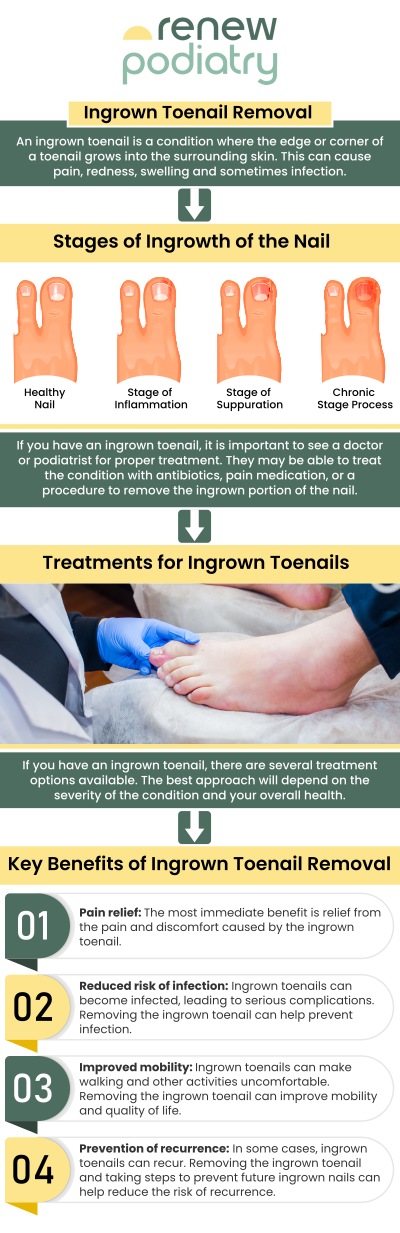 Ingrown toenails are nails that have grown under the soft skin of the toe around the nailbed. This can cause swelling, redness, and pain. When left untreated, ingrown toenails can sometimes lead to infection. Get rid of the pain today! Dr. Charles Baik, DPM at Renew Podiatry offers ingrown toenail treatments. For more information, contact us today or simply request an appointment online. We are conveniently located at 705 West La Veta Ave, Suite 109, Orange, CA 92868.