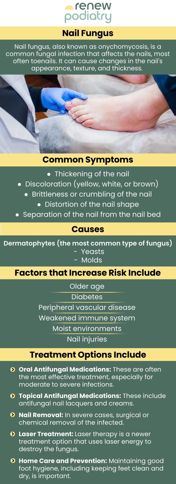 Nail fungus treatment with lasers can work, and it takes several sessions. Dr. Charles Baik, DPM offers a Genesis Laser to treat fungal nails at Renew Podiatry. The Genesis Laser® poses no known risk or harmful side effects of oral anti-fungal medications and is painless, unlike other laser therapies. Contact us today for more information or request an appointment online. Also, check our specials. We are conveniently located at 705 West La Veta Ave, Suite 109, Orange, CA 92868.