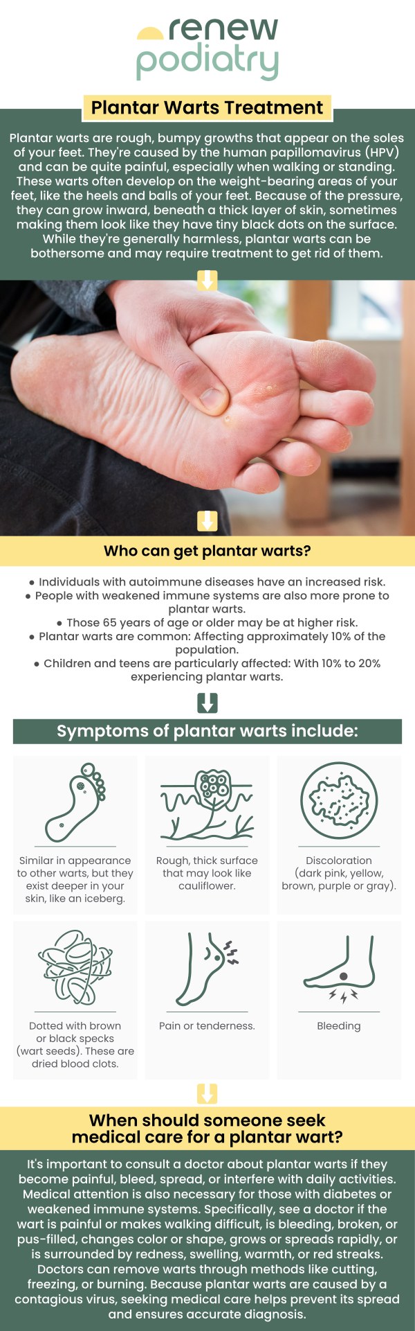 Warts are tiny, rough developments on the soles of the feet. They often appear on the balls and heels of the feet, which bear the most pressure. Plantar warts are the result of the HPV virus that enters the body through small wounds or cracks on the soles of the feet. Most warts aren't dangerous to one's health and will disappear on their own. At Renew Podiatry, our board-certified podiatrist Dr. Charles Baik DPM, is successful at treating the source of the warts so they do not come back! Please contact us for more information or schedule an appointment online. We are conveniently located at 705 West La Veta Ave, Suite 109, Orange, CA 92868.