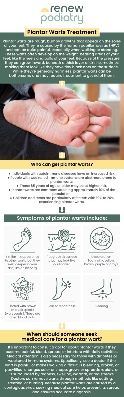Warts are tiny, rough developments on the soles of the feet. They often appear on the balls and heels of the feet, which bear the most pressure. Plantar warts are the result of the HPV virus that enters the body through small wounds or cracks on the soles of the feet. Most warts aren't dangerous to one's health and will disappear on their own. At Renew Podiatry, our board-certified podiatrist Dr. Charles Baik DPM, is successful at treating the source of the warts so they do not come back! Please contact us for more information or schedule an appointment online. We are conveniently located at 705 West La Veta Ave, Suite 109, Orange, CA 92868.